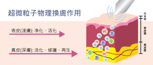 RF Diagram